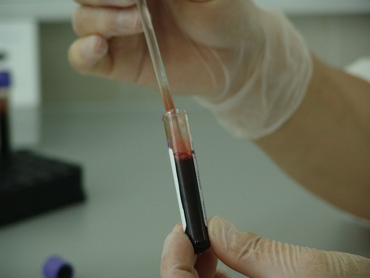 badanie z krwi na boreliozę
